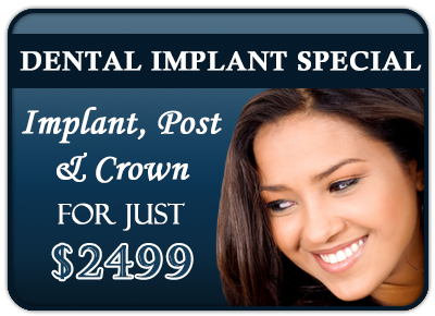dental_implant_special